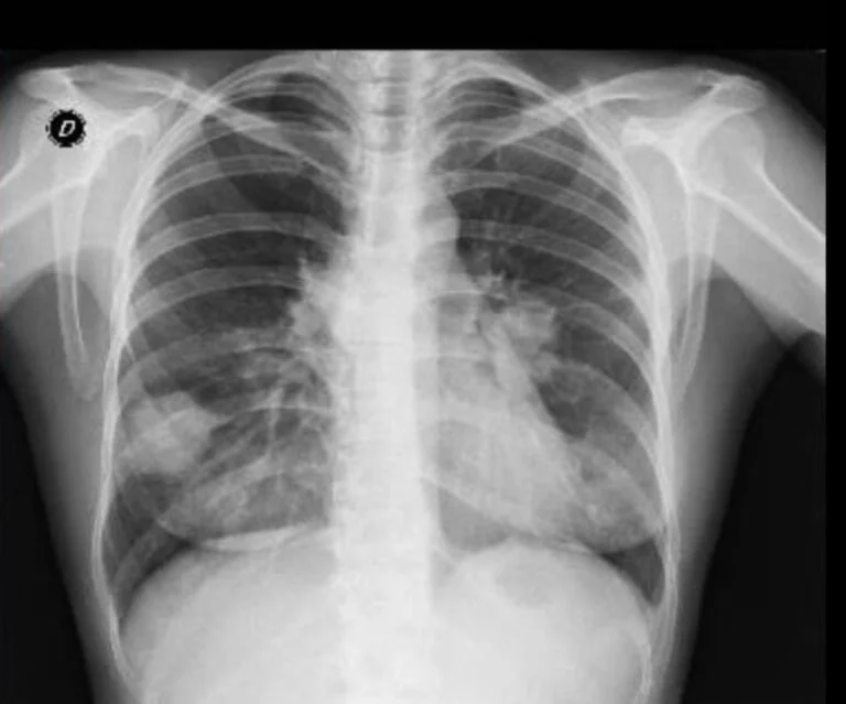 Imagen del caso Una radiografía, muchas opciones diagnósticas